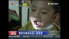  疱疹性咽颊炎疯狂来袭，防治要这么做！ 